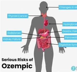 Ozempic risks