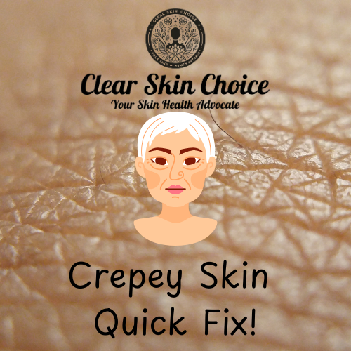 crepey skin quick fix